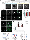 Generation of limb-innervating motor neurons from isogenic MFN2R94Q/+ and M