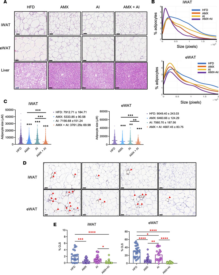 Combination therapy with amlexanox and AICAR reduces adipocyte hypertrop...