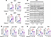 Fasting induces TBK1 at both the transcriptional and protein levels.