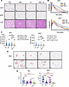 Combination therapy with amlexanox and AICAR reduces adipocyte hypertrophy