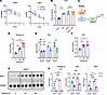 PGC1α is required for the transcriptional induction of Tbk1 during fasting.
