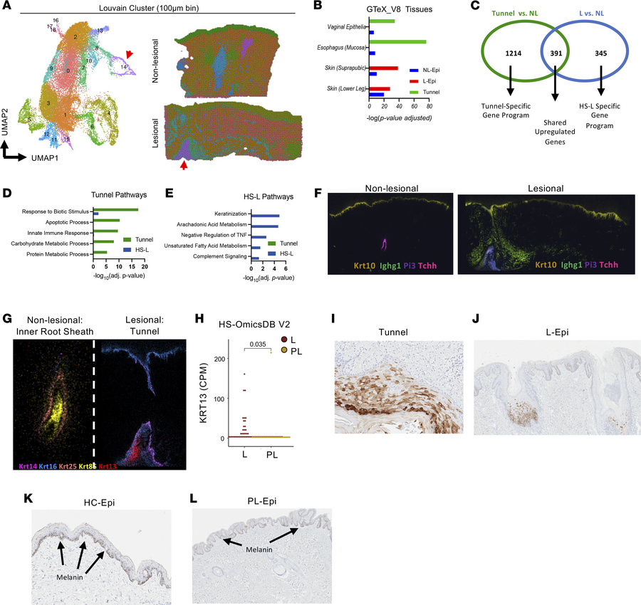 STEREOseq identifies HS tunnels bearing a mucosal epithelia phenotype.
(...
