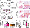 Murine endothelial KO of Gdf15 is protective.
