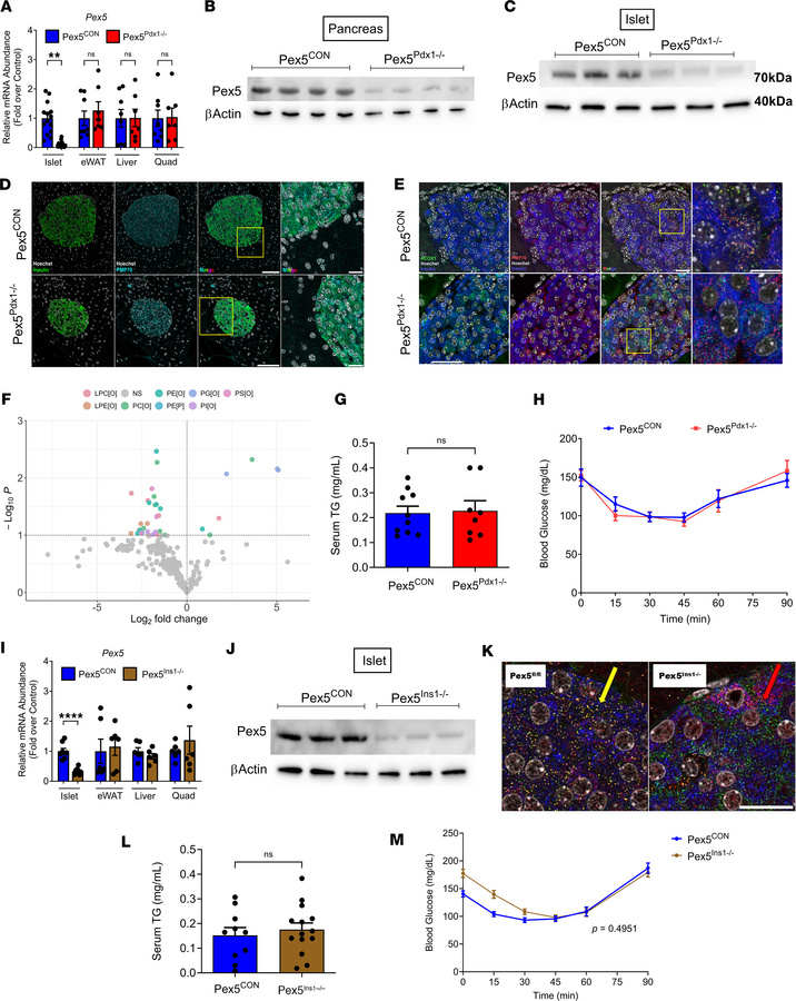 Pancreas- and β cell–specific deletion of Pex5 impairs peroxisomal matri...