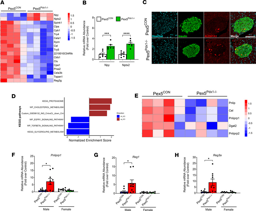 Loss of functional peroxisomes in pancreatic tissue promotes β cell dedi...