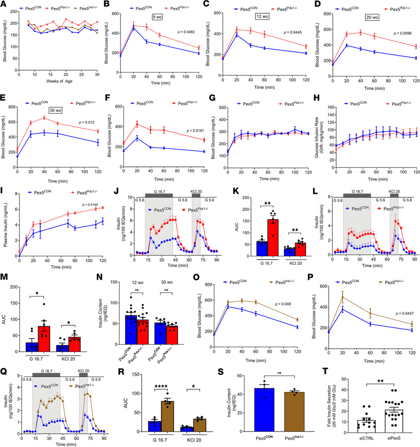 Peroxisomes are critical for maintenance of glucose tolerance and β cell...