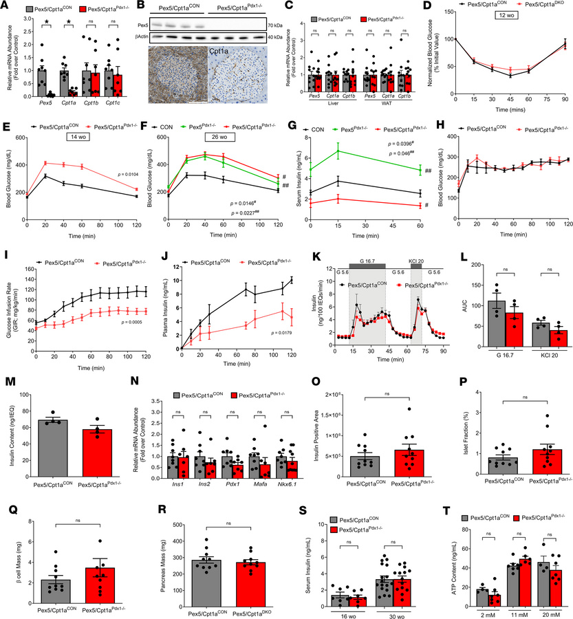 Reduction in CPT1a abundance in peroxisomal-deficient male mice restores...