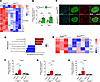 Loss of functional peroxisomes in pancreatic tissue promotes β cell dediffe