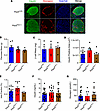 Reduced peroxisomal function in the pancreas of male mice has no impact on