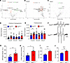 Coordinated alterations in oxidative stress signature in pancreas and islet