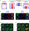 Global shifts in transcriptional signature in islets from male Pex5Pdx1–/–