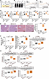 IL-10 suppresses hepatic lipid accumulation in HFD-fed mice.