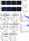 IL-10 suppresses hepatic apoptosis in HFD-fed mice and normal human hepatoc