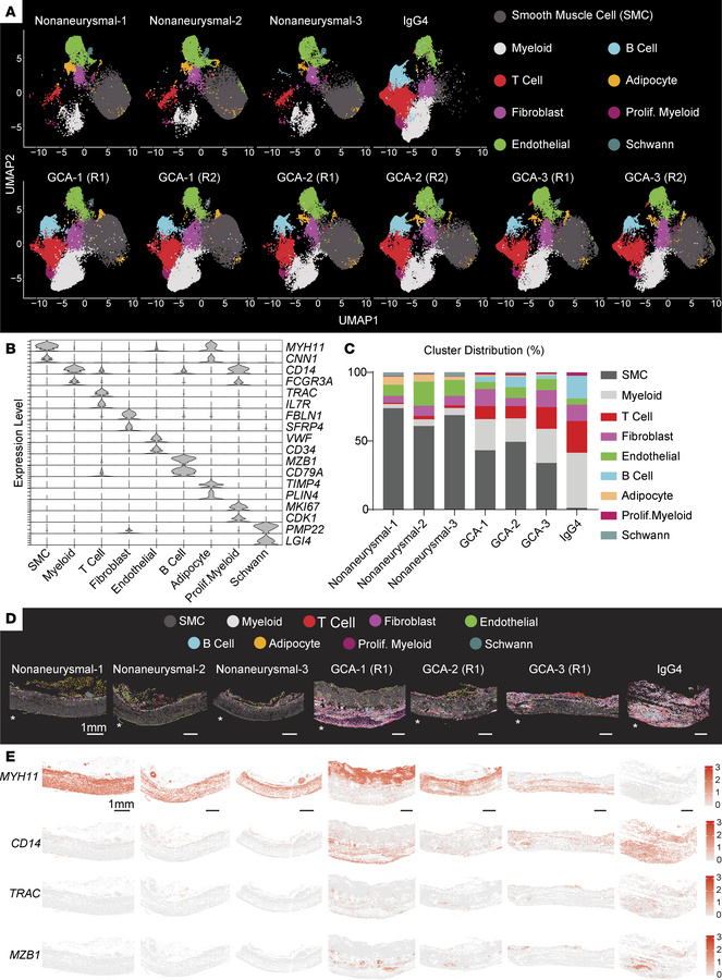 Spatial landscape of vascular remodeling in aortitis vessels.
(A) Unifor...