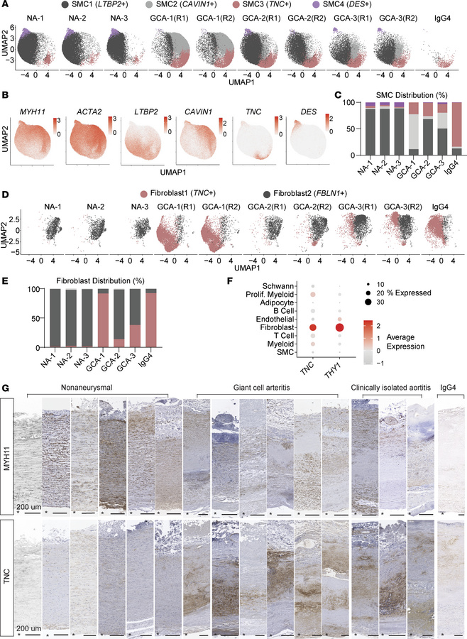 Subclustering analyses reveal proinflammatory vascular smooth muscle and...