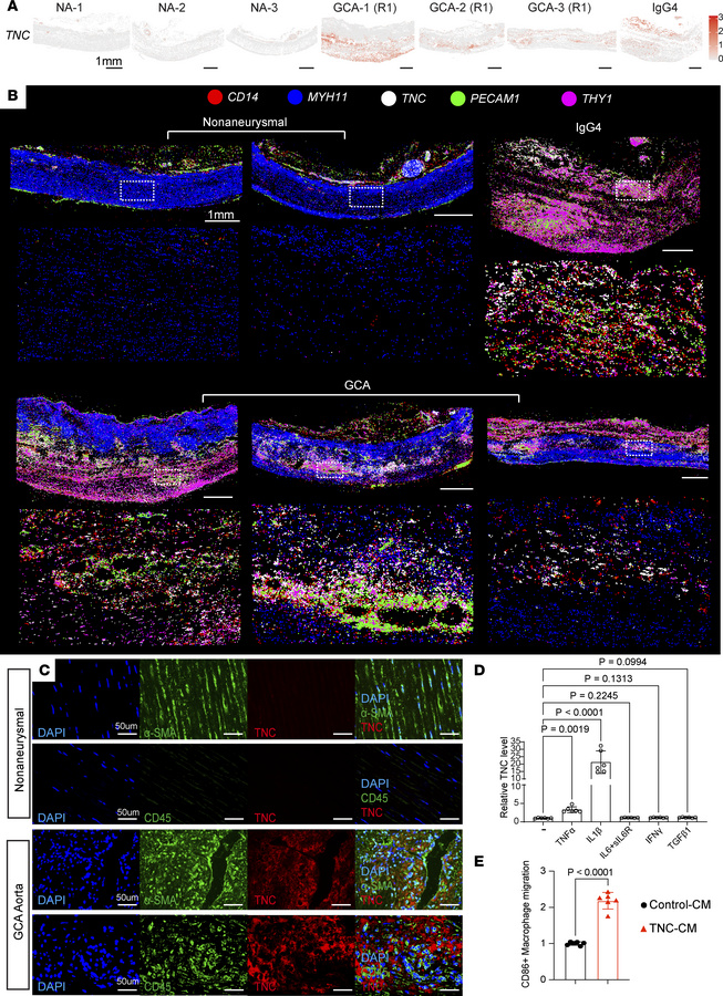 Tenascin-C accumulates in aortitis lesions.
(A) Spatially resolved norma...