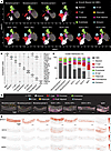 Spatial landscape of vascular remodeling in aortitis vessels.