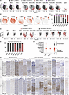 Subclustering analyses reveal proinflammatory vascular smooth muscle and fi