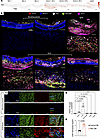 Tenascin-C accumulates in aortitis lesions.