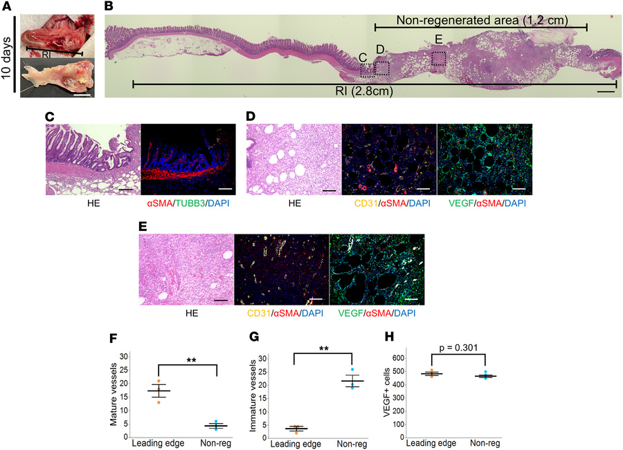 Evaluation of the intestinal regeneration process in 10 days after DITx....