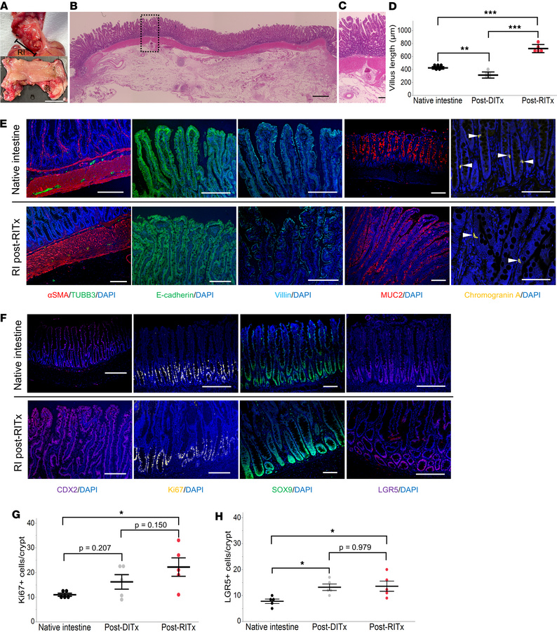 Histological evaluations of the regenerated intestine 4 weeks after RITx...