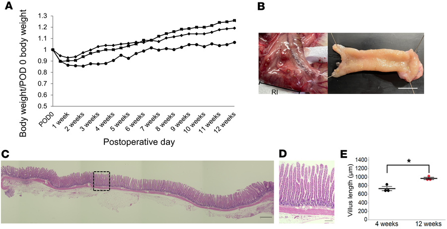 Long-term outcomes in the RITx group.
(A) Changes in the body weight los...
