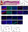 Histological evaluations of the regenerated intestine 4 weeks after RITx.