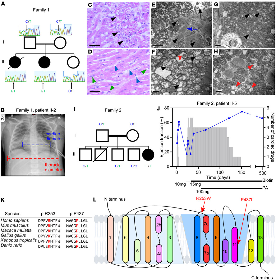 Clinical presentation and identification of the SLC5A6R253W mutation.
(A...