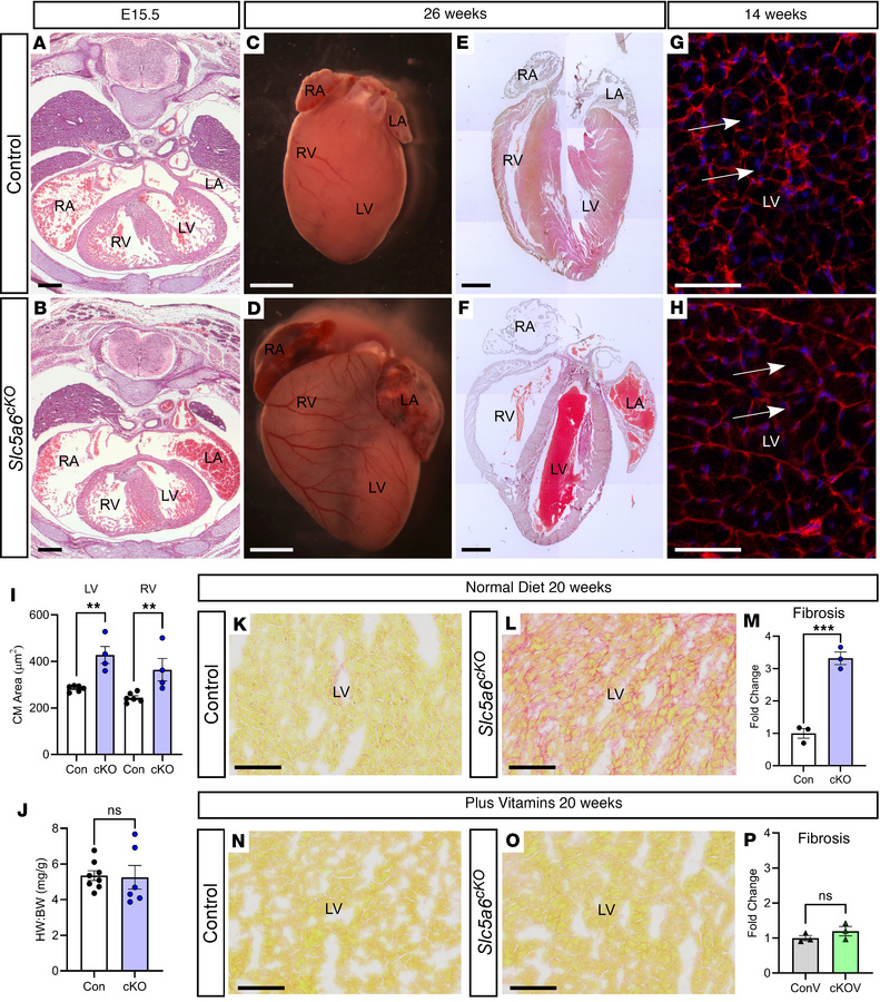 Cardiac-specific Slc5a6-KO (Slc5a6cKO) mouse recapitulates a cardiomyopa...
