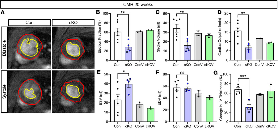 Impaired cardiac contractility and ventricular remodeling in Slc5a6cKO m...
