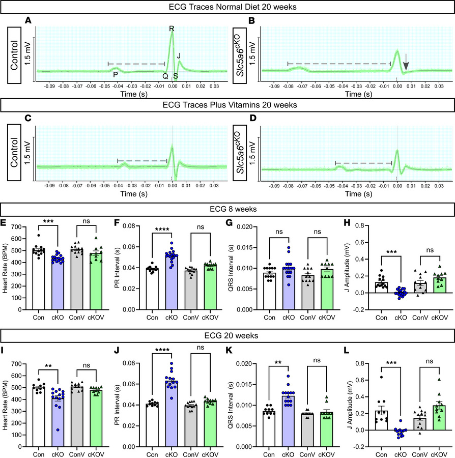 
Slc5a6cKO mice develop progressive electrical conduction abnormalities ...