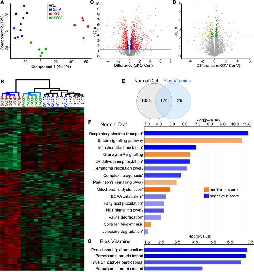 Proteomic analysis revealed altered metabolism and increased fibrosis co...