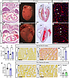Cardiac-specific Slc5a6-KO (Slc5a6cKO) mouse recapitulates a cardiomyopathy
