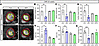 Impaired cardiac contractility and ventricular remodeling in Slc5a6cKO mice