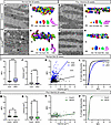 Increased mitochondrial complexity following loss of Slc5a6 is prevented by