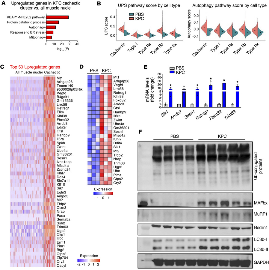 Upregulation of proteolytic systems in cachectic myofibers.
(A) Enrichme...