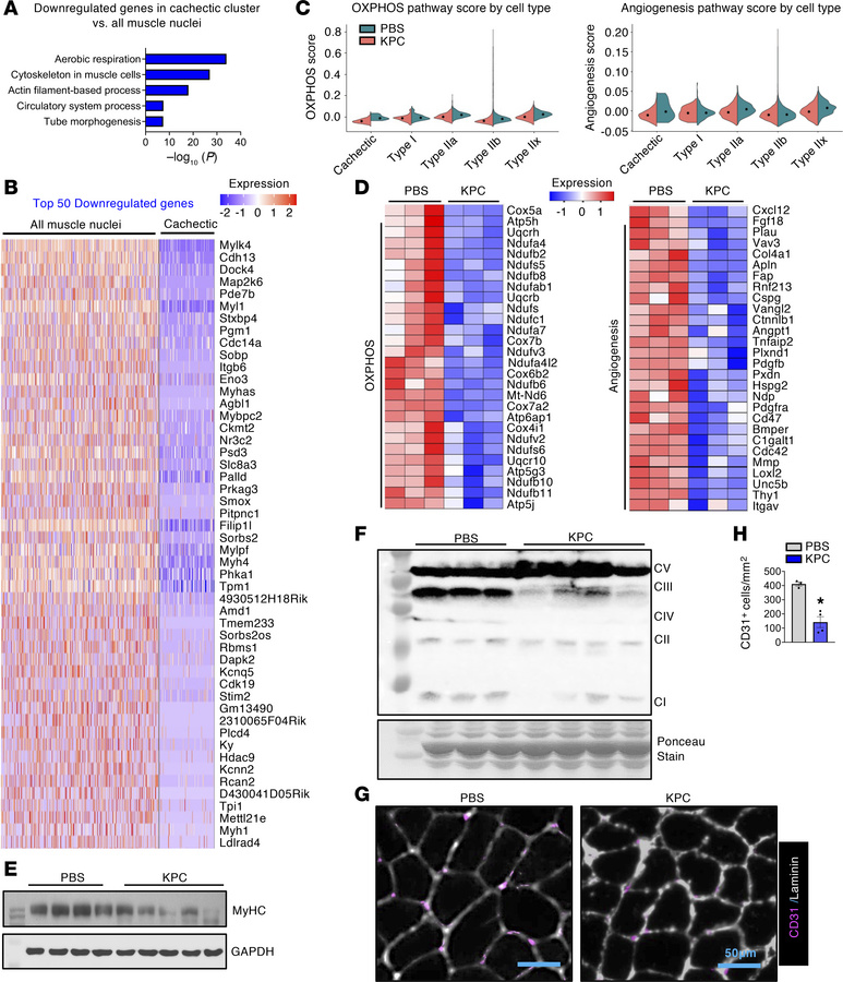 Downregulation of oxidative phosphorylation and angiogenesis pathway in ...