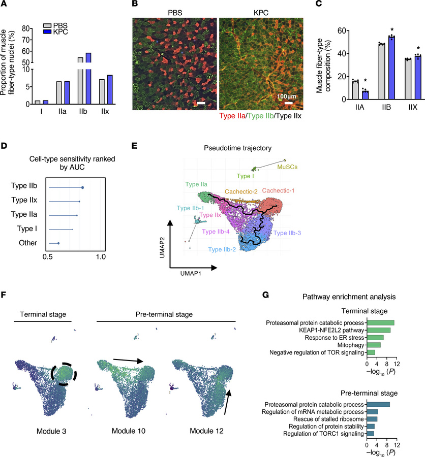 KPC tumor growth causes fiber-type remodeling in skeletal muscle.
(A) Pr...