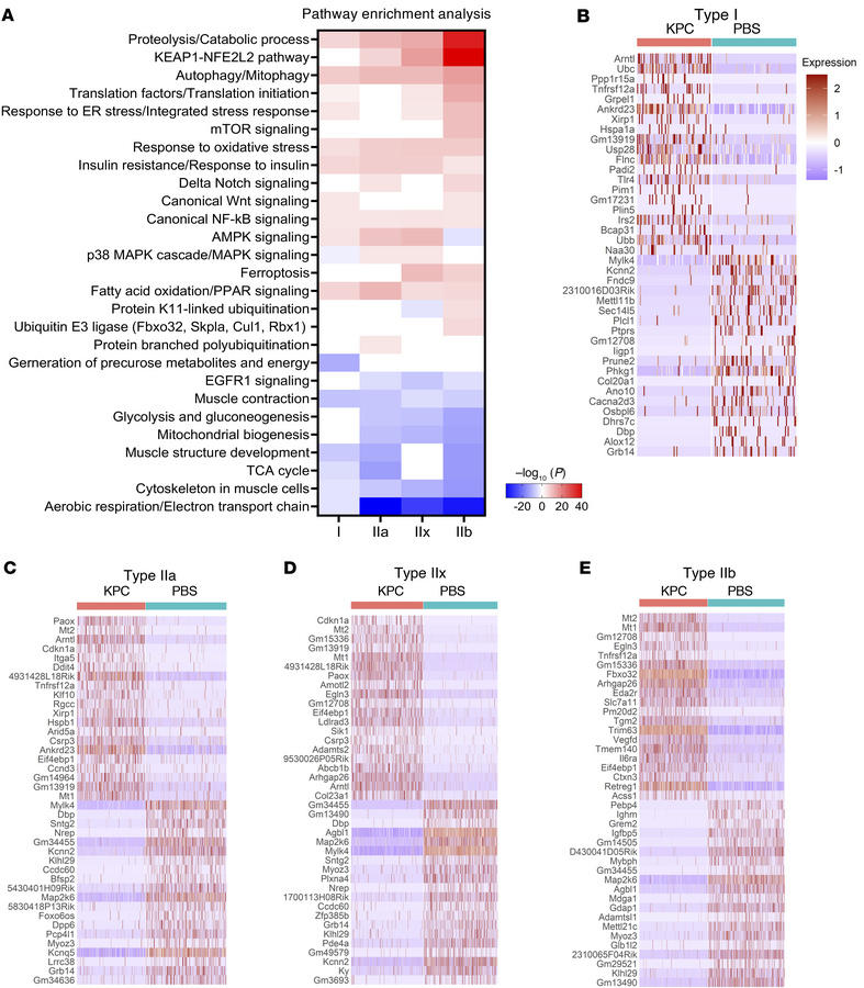 Transcriptome analysis of different myofiber types in control and KPC tu...
