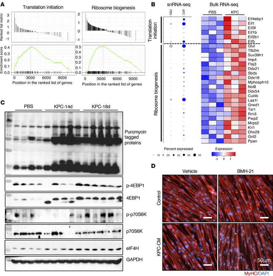 Increased ribosome biogenesis and translation initiation in skeletal mus...