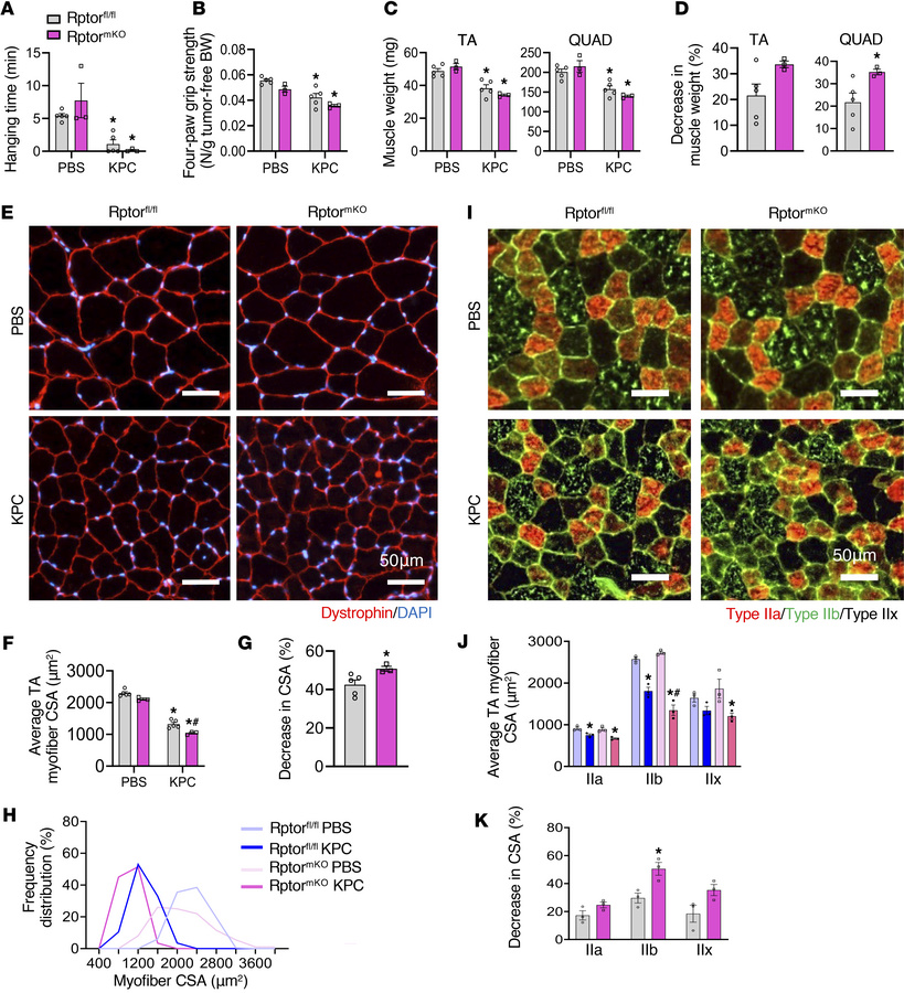 Deletion of Raptor exacerbates muscle loss in response to KPC tumor grow...