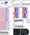 Downregulation of oxidative phosphorylation and angiogenesis pathway in cac
