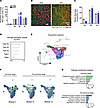 KPC tumor growth causes fiber-type remodeling in skeletal muscle.