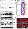 Increased ribosome biogenesis and translation initiation in skeletal muscle
