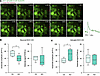 Opposite effects of cell-selective NCX1 deletion on extracellular glutamate