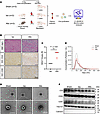 Characterization of plasma-derived EVs in cardiac allograft rejection model