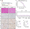 Depletion of endogenous circulating EVs exacerbates systemic and intragraft
