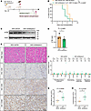 Genetic silencing of hepatic ATIII accelerates cardiac allograft rejection