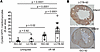LCTB-92 promotes CM reentry after I/R MI.