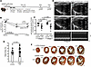 Ablation of cycling CMs attenuates beneficial effects of LCTB-92 treatment.